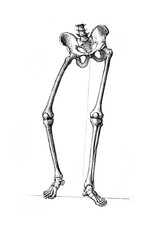 Position of the limb in the first period of coxalgia in the old book D'Anatomie Chirurgicale, by B. Anger, 1869, Paris
