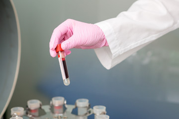 Doctor's hand in glove with blood test tube on centrifuge background.