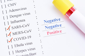 Blood sample tube positive with COVID-19 or novel coronavirus 2019 found in Wuhan, China