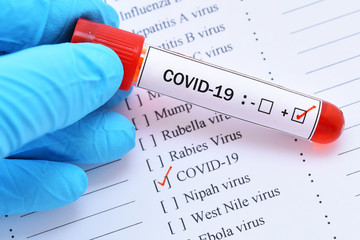 Blood sample tube positive with COVID-19 or novel coronavirus 2019 found in Wuhan, China