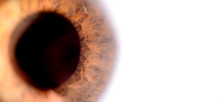 Ojo