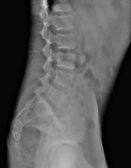 x- ray of the lumbar and sacral spine in a lateral projection