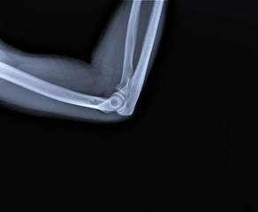 x- ray of a normal elbow joint