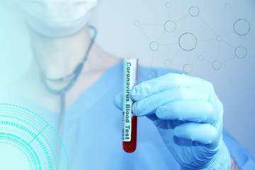 medical laboratory test tube with blood in the hand of a virologist doctor, concept of virology,...