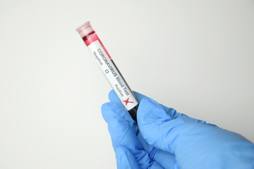 Obraz premium coronavirus looks like a pandemic