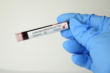 Fototapeta premium coronavirus looks like a pandemic