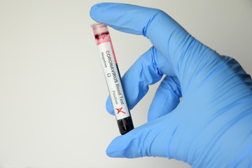 coronavirus blood test