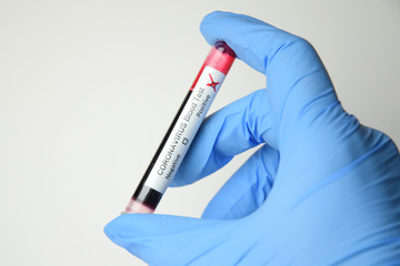 coronavirus blood test
