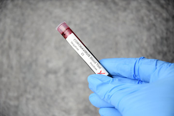 Fototapeta premium Coronavirus COVID