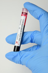 Fototapeta premium Coronavirus COVID
