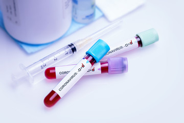 Positive blood test in vacuum tube for the new rapidly spreading Coronavirus COVID-19 biochemical analysis. Coronavirus concept.