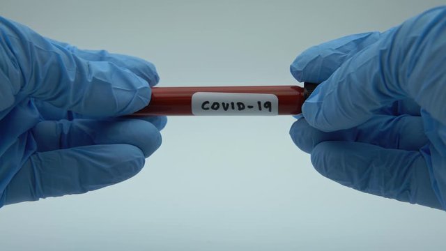 4K, Positive COVID-19 test and laboratory sample of blood testing for diagnosis new Corona virus infection. Disease 2019 from Wuhan. Pandemic infectious concept-Dan