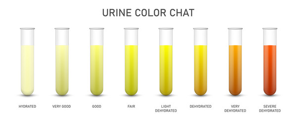 Creative vector illustration of Urine test chat, assessing hydration, dehydration, test tubes isolated on background. Art design pee urine color diagram template. Concept medical biomaterial element - obrazy, fototapety, plakaty