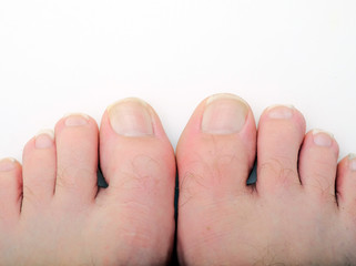 legs with untrimmed nails close up on a white background