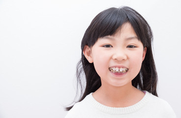 歯の矯正をする小学生の女の子