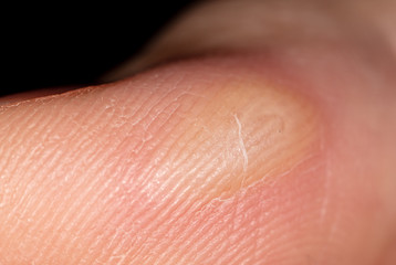 Corn on a finger isolated on a black