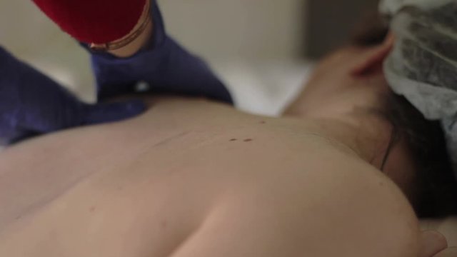 Homemade back massage of the girl. Gentle massage in the area of a mole. Health concept. Pigmented naevus