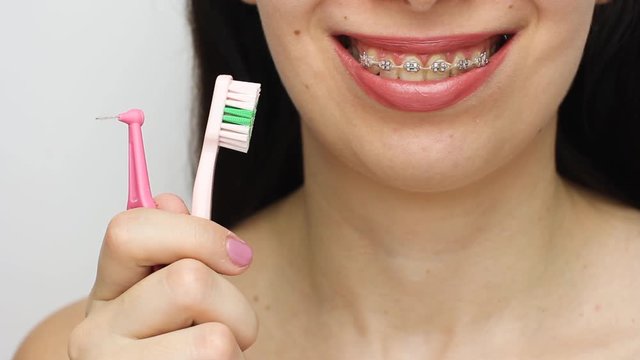 Two types of brush for cleaning teeth with dental braces. Brackets on the teeth after whitening. Self-ligating brackets with metal ties and gray elastics or rubber bands for perfect smile.