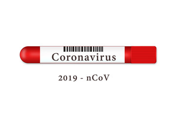 Test tube on a white background with the result of 2019-nKoV coronavirus.Pandemic infection concept