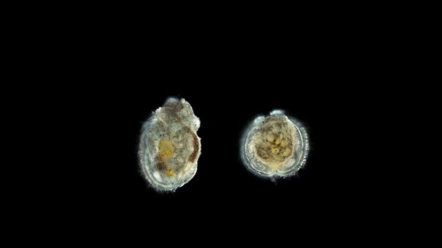 larva Kamptozoa under the microscope, type Protostomia, of the family Loxosomatidae, feed on detritus and microscopic algae, mainly lead an attached lifestyle.