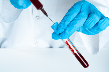 Doctor in blue gloves keep in hands test tube with a blood and syringe