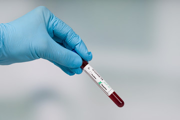 hand in blue glove holding a covid-19 blood test tube with result in front of a lab room