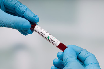 Obraz premium hand in blue glove holding a covid-19 negative blood test tube in front of a lab room