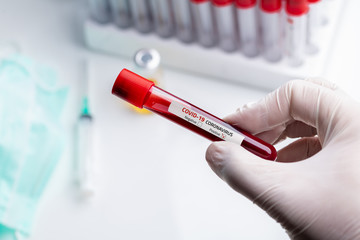 Coronavirus Blood Sample