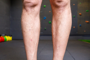 Closeup legs men skin and hairy with grey background, health care and medical concept.