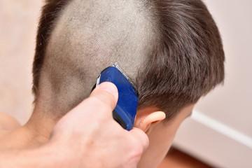 Haircut of a boy on a bald head with a hair trimmer. Close-up
