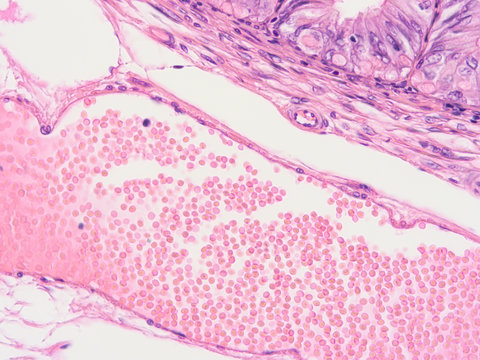 picture of histology human tissue with microscope from laboratory (not Illustration Designation)	
