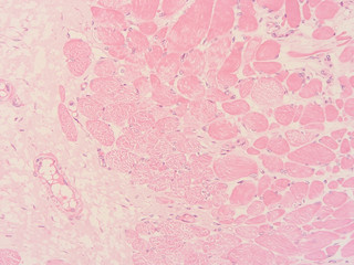 picture of histology human tissue with microscope from laboratory (not Illustration Designation)	