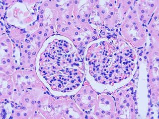 picture of histology human tissue with microscope from laboratory (not Illustration Designation)	
