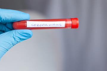 Obraz premium test tube in hand, inscription virus, coronavirus study, virus research