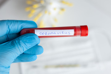 test tube in hand, inscription virus, coronavirus study, virus research