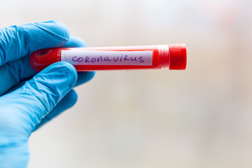 test tube in hand, inscription virus, coronavirus study, virus research