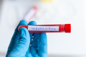 test tube in hand, inscription virus, coronavirus study, virus research