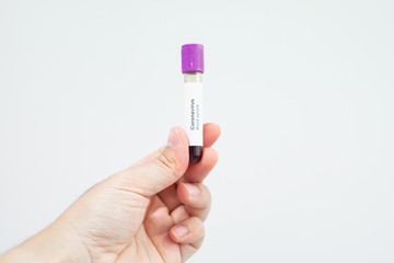 Asian male doctor holding Covid-19 Blood Sample on White Background