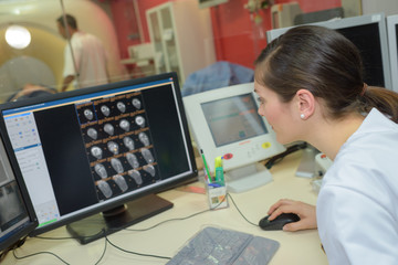 doctor typing on computer while looking at 3d images
