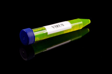 Sample liquid in the test tube with text VIRUS isolated on the black background