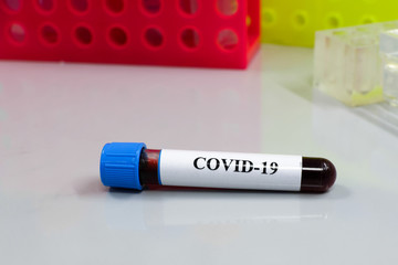 Blood test for COVID-19.