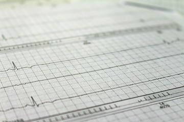 Electrocardiogram strips with cardiac arrhythmias. Heart attack. Selective focus on some beats. Free space to write.