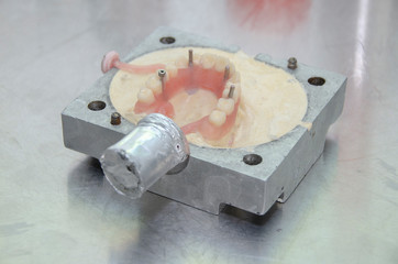 Dental laboratory, acrylic injection work for dental prostheses
