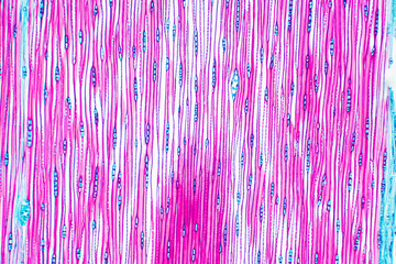 Histological structure of pine stem vascular bundle under microscope.