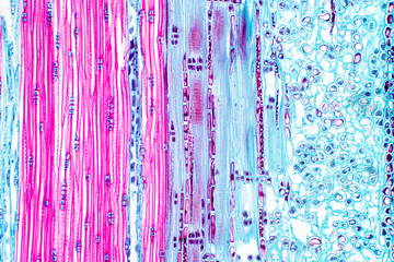Histological structure of pine stem vascular bundle under microscope.