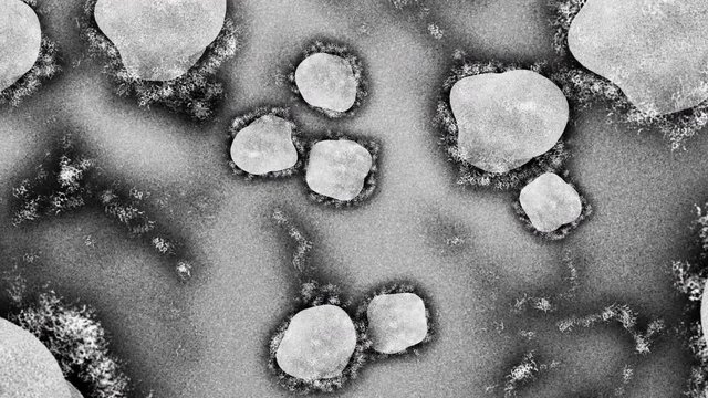 Animation of the microscopic view of the infectious Covid-19 Corona Virus with moving cells