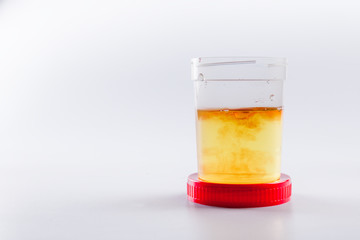 Cloudy or bloody urine sample in sterile plastic container on white background with, cloudy or...