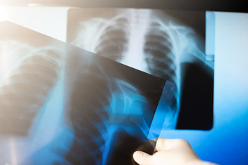 Doctor examines an x-ray photograph in a hospital