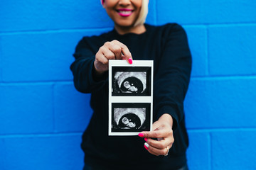 Woman holding sonogram on colorful wall - baby gender reveal