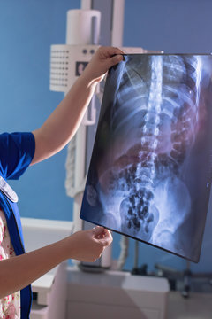 examining spine x-ray